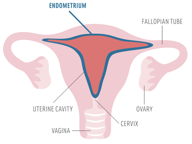 Uterus diagram